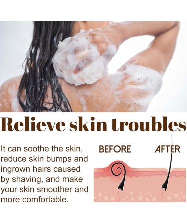 Zawina Black Soap Zawina Moroccan Black Soap African Black Soap Bar Zawina Morocco Body Scrub Zawina Morocco Black Soap Deep Cleaning For Whole Body (1PC) - Buy Online on GoSupps.com