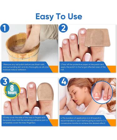 32Pcs Nail Repair Patches - Toenail Fungus Treatment for Damaged Nails - Buy Online on GoSupps.com