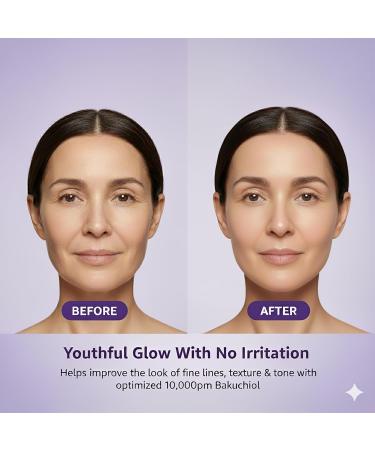 Bakuchiol Serum for Face - DIY Mix-in Concentrate - Korean Bakuchiol Plumping Serum - Customizable Retinol Alternative Add-On for Skincare Routines - Buy Online on GoSupps.com