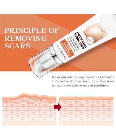 scar removal cream scar care cream scar treatment gel scar removal cream for surgical scars acne scars cesarean section - Buy Online on GoSupps.com