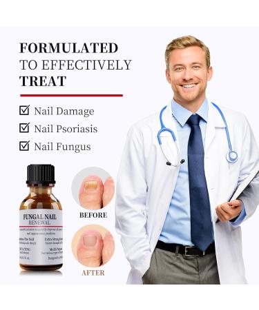 Extra Strength Toenail Fungus Treatment - Fast Acting Nail Repair Liquid for Discolored Nails with Nail File - Buy Online on GoSupps.com