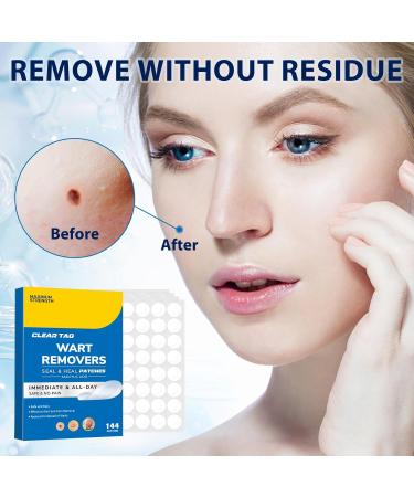 Effective Wart Remover Stickers - Safe Skin Care Solution for All Skin Types | 144 Patches - Buy Online on GoSupps.com