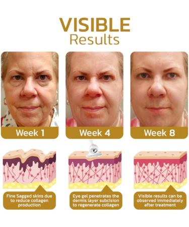 EXQST Solid Peptide Firming Eye Gel Caffeine Eye Cream Collagen Roller Eye Cream Eye Gel for Dark Circles and Puffiness AntiAging Eye Cream Reduces Fine Lines and Wrinkles - Buy Online on GoSupps.com