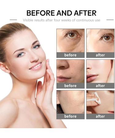 Face Moisturizer Face Cream Skin Care Beauty with Niacinamide & Retinol Removes Acne Redness Fade Dark Spots (100g) - Buy Online on GoSupps.com