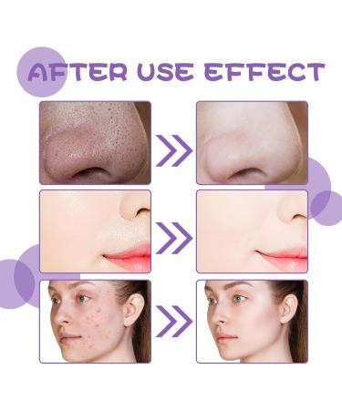  Utapossin Anti-Pimple Cleansing Mask Anti-Blackhead Cleansing Mask Deep Cleansing for Oil Control Deep Cleanses Pores - Buy Online on GoSupps.com