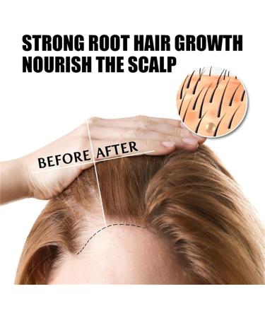 Pumpkin Seed Oil For Hair Organic Pumpkin Seed Oil for Hair Pumpkin Seed Oil Fast Hair Growth Serum Pumpkin Seed Oil Natural Hair Growth Eyelashes and Eyebrows Skin Massage 60 ml (3 Pieces) 3pc - Buy Online on GoSupps.com