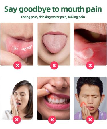Mouth Ulcer Treatment Spray Mouth Ulcer Spray Mouth Ulcer Treatment for Adults Canker Sore Treatment Herbal Mouth Spray Breath Spray for Bad Breath Canker Relief Spray Mouth Freshener Spray 20ml - Buy Online on GoSupps.com