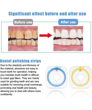 Dental Abrasive Paper Yellow - Dental Polishing Strips - Small Size: 20 m - Medium Size and Size - Blue Dental Polishing Strips - 30 m - Grit Size: 4 mm Wide - - Buy Online on GoSupps.com