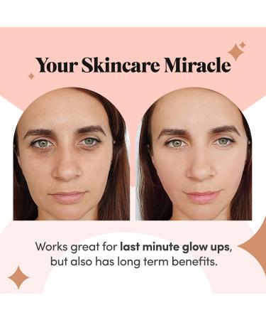 Rose Gold Collagen Under Eye Gel Mask - Bright Eyes Anti Aging Treatment for Dark Circles, Puffy Eyes, Bags & Fine Lines - 30 Pairs - Buy Online on GoSupps.com