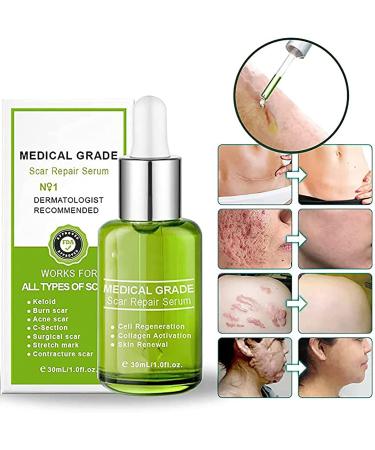 Goopgen Advanced Scar Repair Serum 2023 - Medical Grade Nature Scar Treatment Set - Buy Online on GoSupps.com