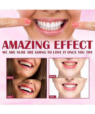 SP-4 Probiotic Whitening Toothpaste - Brightening & Tartar Removal for Complete Dental Care | 1PC - Buy Online on GoSupps.com