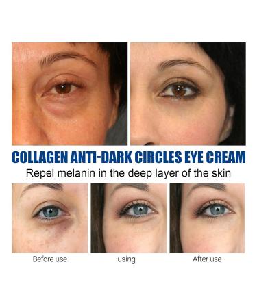 Jasmine Eye Cream - Wrinkle & Dark Circle Treatment Tear Bag Relief - 1PC - Buy Online on GoSupps.com