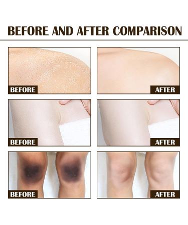 Organic Coffee Scrub Coffee Renewing Body Scrub Organic Coffee Exfoliating Body Scrubber 2023 Newest Best Arabica Coffee Renewing Body Scrub (3 Pcs) - Buy Online on GoSupps.com