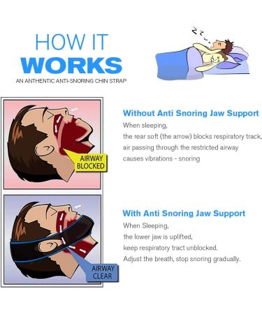 2024 Anti-Snoring Chin Strap | Effective Snoring Relief | Professional Snore Stopper International Shipping Available - Buy Online on GoSupps.com