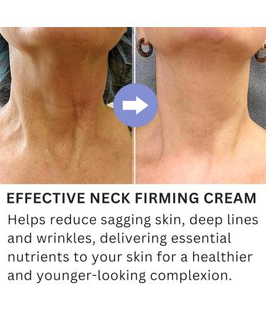 Advanced Anti-Aging Neck Cream - Tighten Lift & Hydrate Skin | Fine Lines & Sagging Skin Solution - Buy Online on GoSupps.com