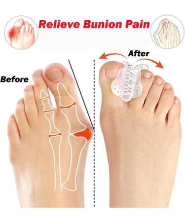 Haosem Gel Toe Spreader - 2/4 Pieces for Big Toe Alignment & Bale Toe Correction - Restore Toes Comfortably - Buy Online on GoSupps.com