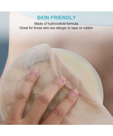 KONWEDA Ostomy Barrier Strips | Pack of 10 Elastic Strips for Colostomy Bags - Buy Online on GoSupps.com