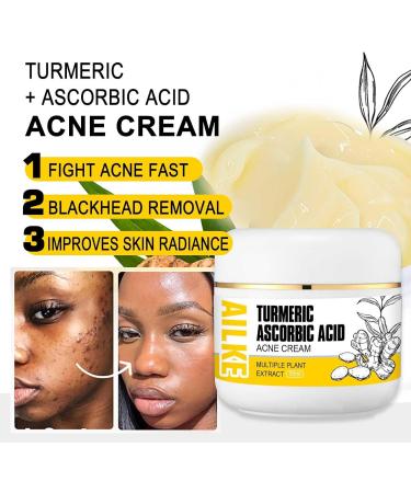 AILKE BOOST LUSTER AILKE Natural Turmeric Acne Remove Face Cream Brightening Reduce Blackheads Pimples With Niacinamide and Multiple Plant Extracts Clean Skin Unclog Pores 50g Pack of 3 - Buy Online on GoSupps.com