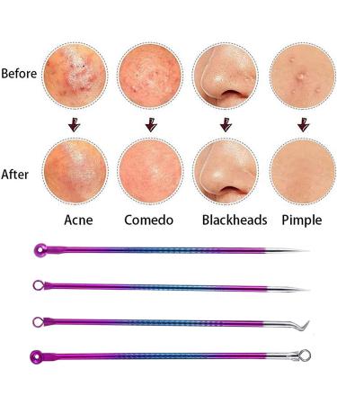Rosarden Blackhead Remover Tool Kit 4 Pieces Comedone Extractor Tool Blemish Whitehead Removal Acne Needle Pimple Spot Popper Stainless Steel (Color) Gold - Buy Online on GoSupps.com