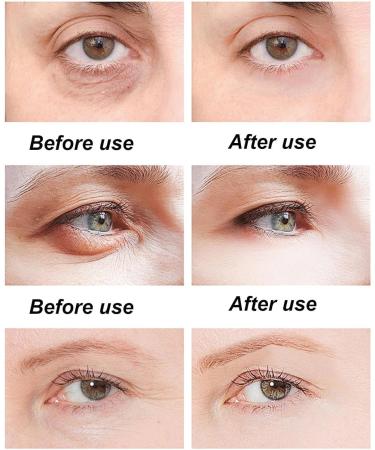JIAOY Vitamin C serum stick whitening serum stick with vitamin C eye balm lightens and reduces swelling moisturizing balm for face and body compensates 3 pieces 3 pieces - Buy Online on GoSupps.com