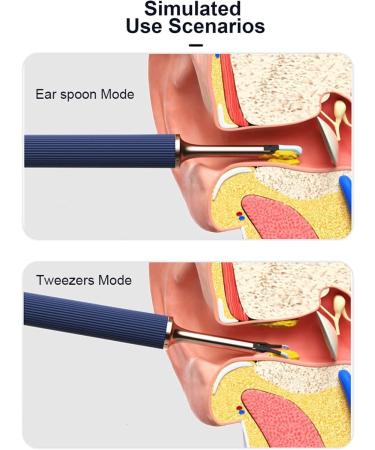 HeiDD Ear Wax Removal Tool Earwax Remover 10 Megapixel HD Ear Wax Removal with Camera Ear Cleaner Wax Removal Tool for Adults Kids Pets Smart Earwax Cleaning Kit (Blue) - Buy Online on GoSupps.com
