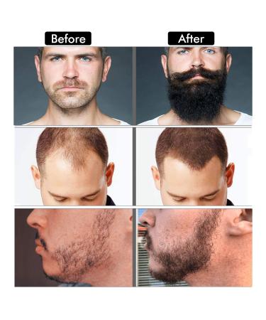 Beard Growth Kit - Derma Roller, Serum Oil, Balm & Comb Set for Stimulating Hair Growth - Perfect Gifts for Men - Buy Online on GoSupps.com