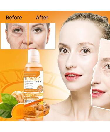 Turmeric Oil Turmeric Face Serum Dark Spot Correcting Glow Serum Reduces Age Spots Sun Spot Improve Brightening Moisturzing Body Face Oils and Serums (Turmeric Oil) - Buy Online on GoSupps.com