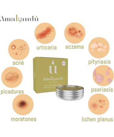 Anti Scar Cream Helps Remove Scars Stretch Marks Caesarean Section Scars Acne Spots - Moisturizing Aftershave Balm - Amakandu - Buy Online on GoSupps.com
