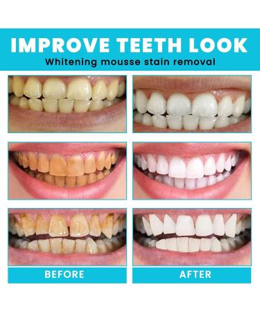 Teeth Whitening Mousse & Foam Toothpaste - Natural Deep Cleaning Oral Care for Refreshing Breath & Stain Removal - Buy Online on GoSupps.com