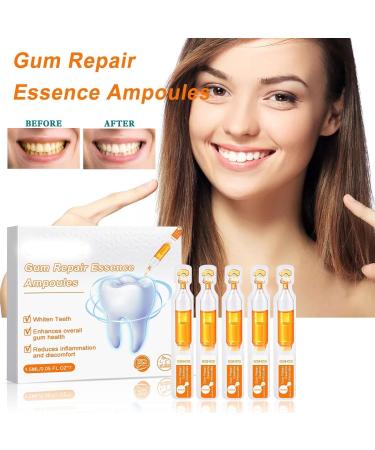 Gum Repair Treatment Ampoules Oral & Gum Care Essence for Tartar Removal Tooth Repair & Gum Protection. (2box) - Buy Online on GoSupps.com