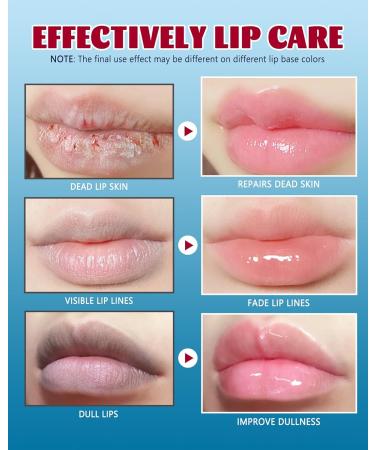  LYSdefeu Lip Repair Gel-2 Moisturizing Lip Balm Fragrance Free for Day and Night Lip Care Moisturizing Balm Kit for Dry and Chapped Lip Repair 10ml x 2 Pcs - Buy Online on GoSupps.com