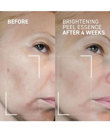 Dr. Brandt Dr. B Lab Brightening Peel Essence - Evens Skin Tone Smooths Skin Texture & Improves Radiance - 3.4 fl oz 3.4 Fl Oz (Pack of 1) - Buy Online on GoSupps.com