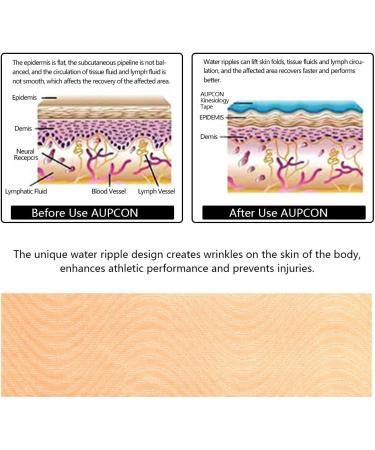 AUPCON Elastic Kinesiology Tape for Sports Recovery and Support - Hypoallergenic Cotton Tape for Knee, Shoulder, Ankle, Elbow, and More - Buy Online on GoSupps.com
