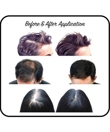 THICKIFY 28g Hair Fibres - Undetectable Hair Loss Concealer for Women & Men - Natural Light Blonde Hair Thickener & Topper - Buy Online on GoSupps.com