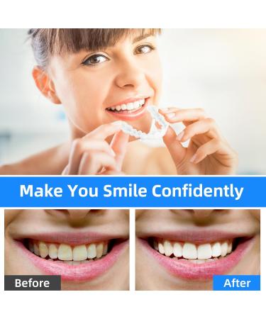 Wisesurf 1 Pairs Instant Veneers Dentures Fake False Teeth Clip in Veneers Teeth Whitening Cosmetic Temporary Tooth Set with Box Snap on Veneers Teeth Top Bottom - Buy Online on GoSupps.com