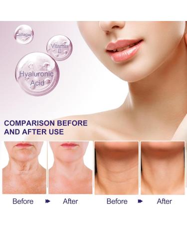 Hyaluronic Acid Neck Cream Firming Neck Cream for Neck Fine Lines Collagen Neck Cream for Neck Wrinkle Suitable for All Skin Types - Buy Online on GoSupps.com