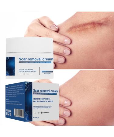 Soothing Scar Removal Cream for Body, Stretch Marks & Tan - Light Blue (One Size) - Buy Online on GoSupps.com