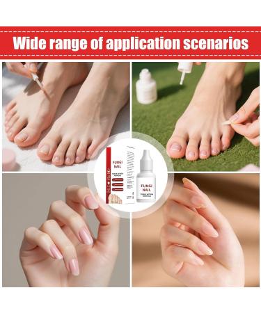 Fingernails Care Liquid 15 ml for all skin types Effective nail solution for toenails and skin ideal for adults elderly women men athletes home travel dormitory - Buy Online on GoSupps.com