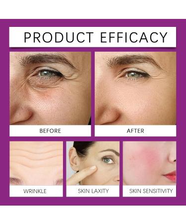 Niacinamide Serum 10% Anti Wrinkle Firming Serum Niacinamide Facial Moisturizing Essence 10% Brightening Dark Spot Correcting Glow Serum Repair Damaged Barrier Minimises Pore Fine Lines - Buy Online on GoSupps.com