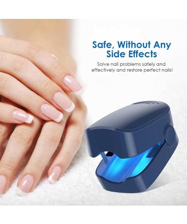Nail Fungus Light Device - Effective Toenail Repair for Discolored & Thickened Nails | Home Use Safe & Fast Results - Buy Online on GoSupps.com