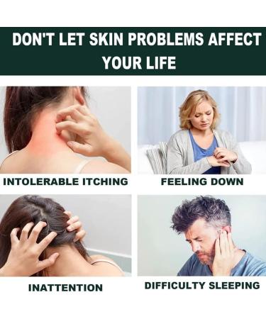 Tonkog Bee Venom Psoriasis Treatment Cream - Soothing and Moisturizing Skin Therapy (5 PCS) - Buy Online on GoSupps.com