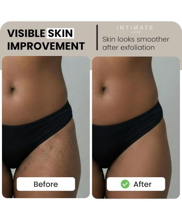 Intimate Luxe Ingrown Defense Scrub Exfoliating Salt Scrub for Bikini Line Underarms & Sensitive Areas Helps Reduce the Look of Ingrown Hair & Rough Texture 8.8 fl oz - Buy Online on GoSupps.com