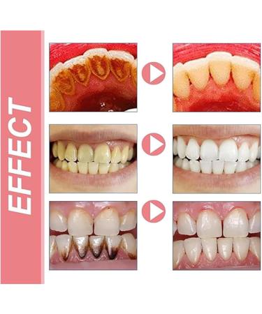 Sp10 Probiotic Toothpaste Sp-10 Ultra Whitening Toothpaste SP-10 Toothpaste Ultra Whitening Toothpaste Sp 10 Toothpaste Sp 10 Pasta Dental Toothpaste Fresh Breath Stain Breath Care - Buy Online on GoSupps.com