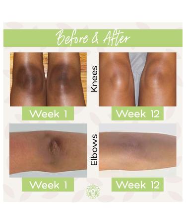 Amaira SOS Intensive Skin Lightening Cream - Natural Brightening & Dark Spot Remover for Face Body Underarms Knees & Elbows (1.7 fl oz) - Shop Internationally - Buy Online on GoSupps.com