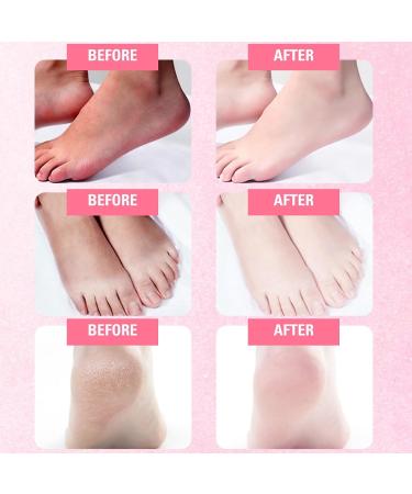 Rose Foot Peel Mask For Hard Skin Rose Foot Peel Mask Rose Foot Mask Exfoliating Feet Peeling Socks Foot Care Mask Plant Formula Moisturising Socks Foot Spa Fits for Women and Men(2 Pairs) - Buy Online on GoSupps.com