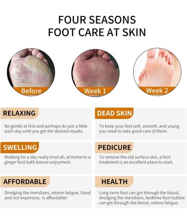 Ginger Foot Soak Salts for Soft, Moisturized Feet - 20 Count Pack to Remove Dead Skin, Repair Cracked Heels - Effervescent Bath Treatment - 7oz - Buy Online on GoSupps.com