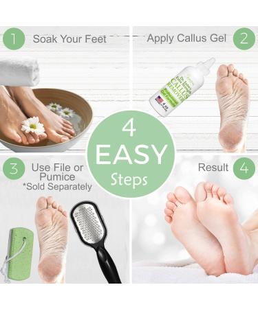 Dr. Entre's Extra Strength Callus Remover Gel - 4 oz | Effective Foot Care & Dead Skin Remover for Smooth Feet | Pedicure Tools & Supplies - Buy Online on GoSupps.com