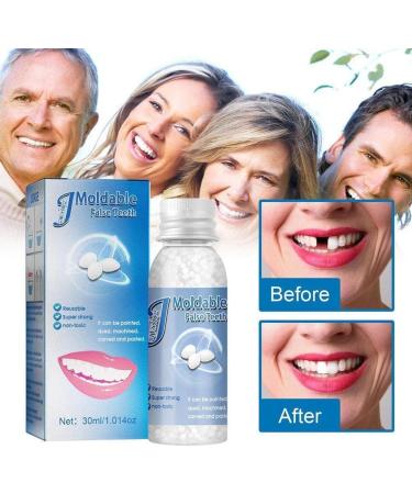 40g Temporary Tooth Repair Kit - Denture Glue for Halloween Cosplay & Film | Instant Tooth Fix - Buy Online on GoSupps.com