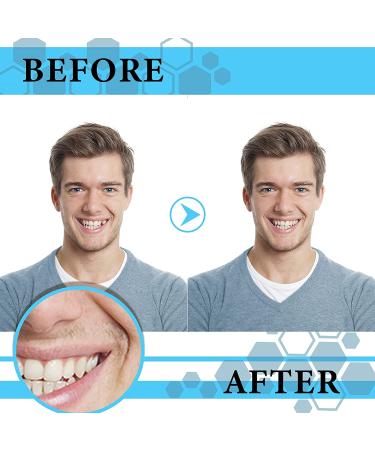 100 Pieces Resin Teeth Veneers for Halloween Cosplay, Scary Theme Party Makeup - Dental Temporary Front and Molar Posterior Teeth for Costume Filling - Buy Online on GoSupps.com