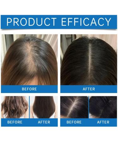 Scalp Ampoule 10ml Hair Strengthening Oil Nongreasy Soothing Roll On Ampoule For Follicle Care And Root Care - Buy Online on GoSupps.com